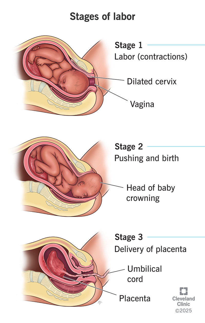 Normal Labour Definition Stages Physiology Management and Clinical Features - OBSTETRICS AND GYNAECOLOGY